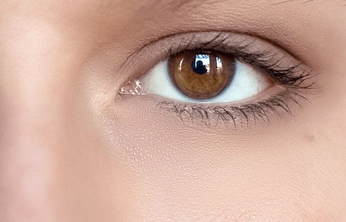 Remove Eye Circles After Remove Eye Circles After