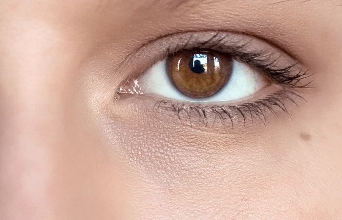 Remove Eye Circles Before Remove Eye Circles Before